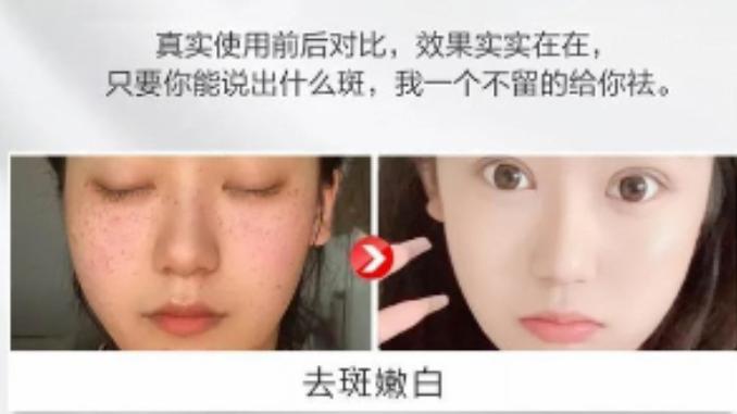 淡斑祛斑用什么护肤品好，中国祛斑十大名牌测评合集，温和高效
