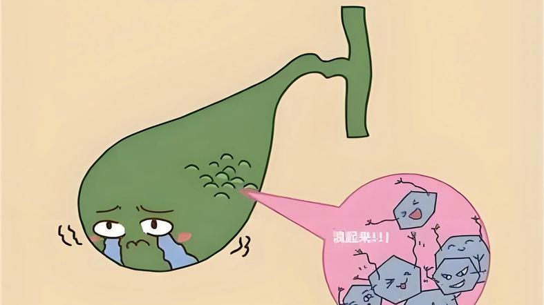 别把胆囊炎当成胃病，延误治疗，远离这3个元凶，做好早期预防