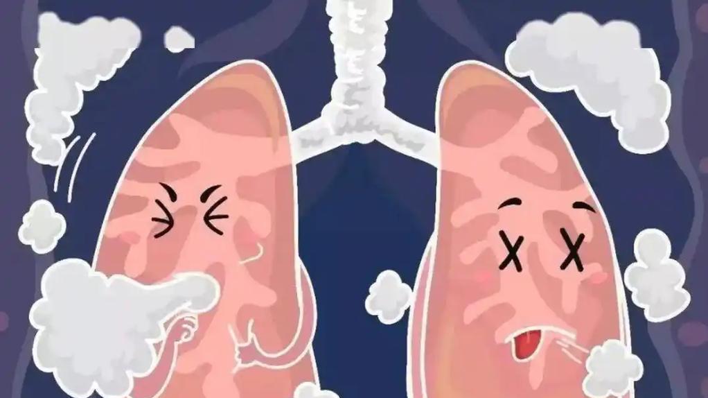 早期肺癌误认为感冒或支气管炎，6类信号别忽视，早期筛查是关键