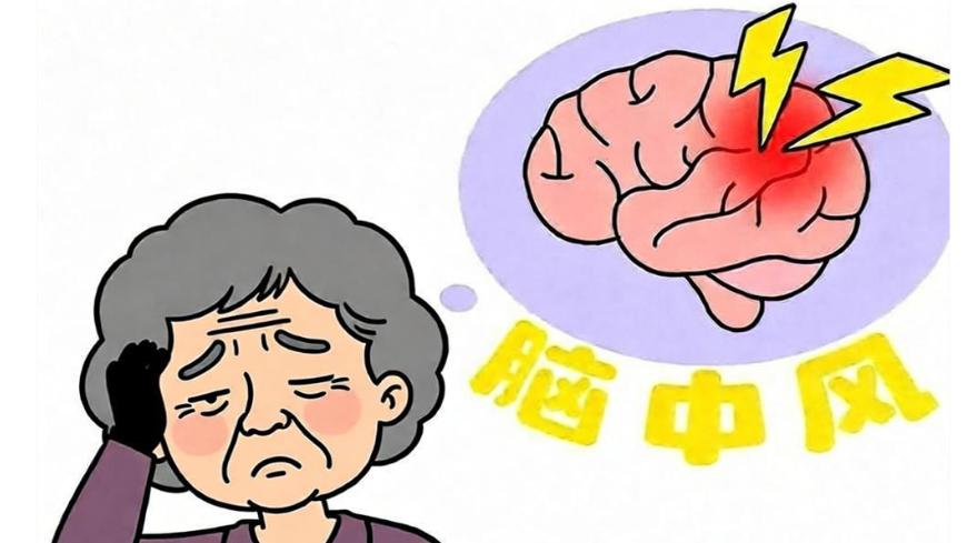 干细胞疗法助力中风康复，临床试验成果令人瞩目