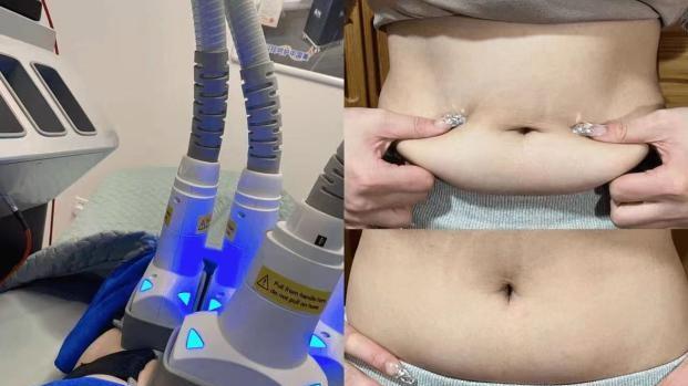 躺着瘦一圈！秀域轰脂拯救我的“顽固游泳圈”