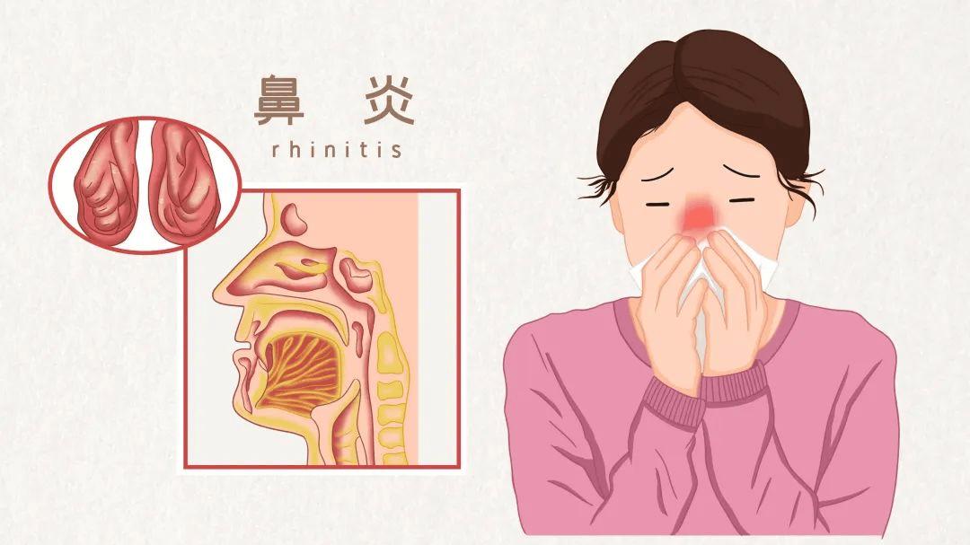 难怪鼻炎越来越严重，这些坏习惯竟然全中！