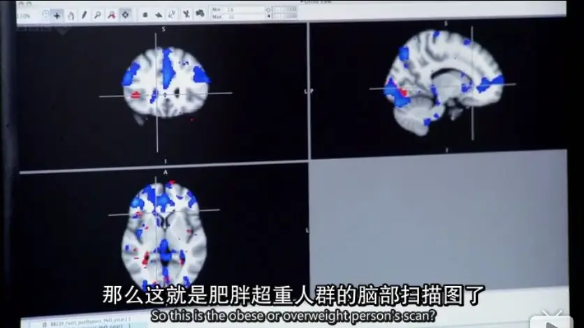 再次颠覆认知！减肥失败不是因为意志力？胖子其实更不容易饿