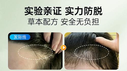 国药准字的防脱生发液 ，国货好用不踩雷，增发密发不脱发