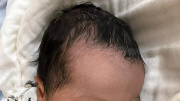 娃出生有这个特征，智力会更高，别不信！