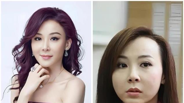 10大整容女星“车祸现场”，个个硅胶乱飞，你认为哪位反差较大？
