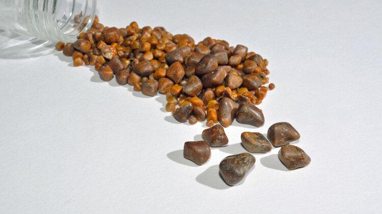 胆结石多半是吃出来的？医生提醒：4种吃饭的坏习惯，尽早改正