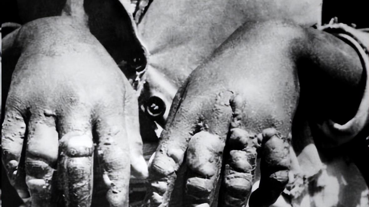 日本值得被原谅吗？他们狠起来给自己下毒，有村庄一夜被毒完