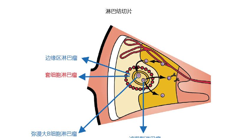 淋巴瘤新药Odronextamab上市申请重新进入FDA审查