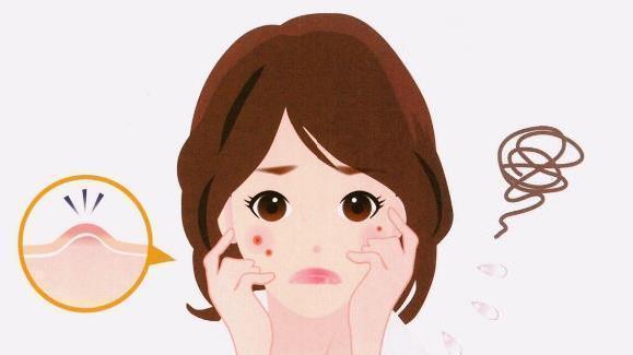 这些祛痘产品，真的不用买！