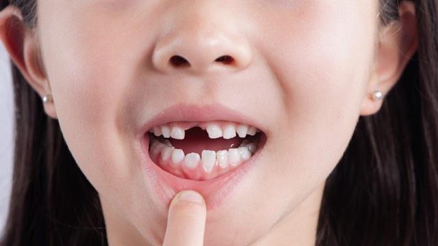 娃乳牙松了，拔还是等？先做这项检查再决定，别坑了恒牙