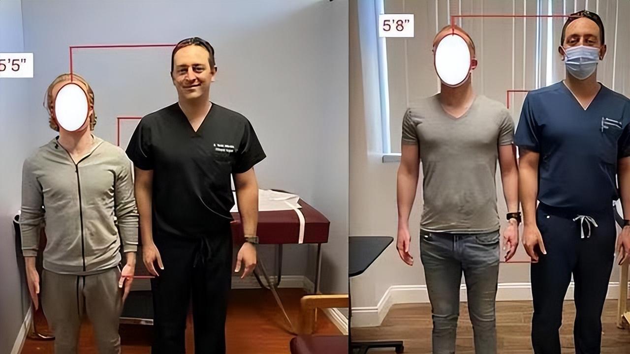 当年花16万断骨，只为增高7.2厘米的李亚诺，如今过得怎么样了？