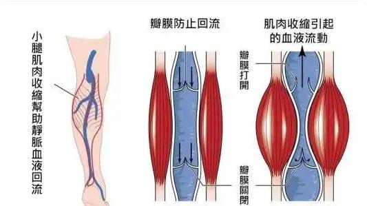 原先只有小腿有静脉曲张，为什么现在大腿甚至大腿根也有了？