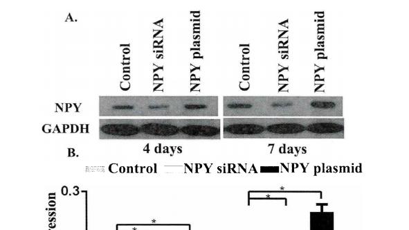 山东大学RFect siRNA转染试剂和RFect质粒转染试剂成功转染小鼠前成骨细胞 MC3T3-E