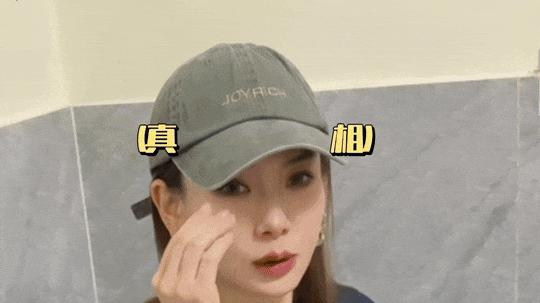 知名女星自曝：肉毒素打多了！