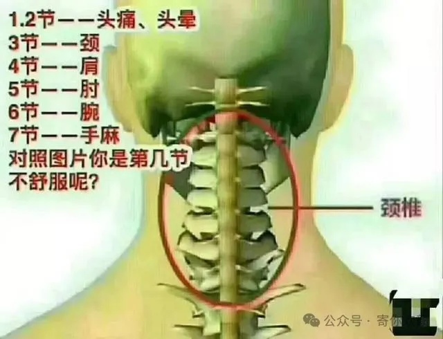 别让颈椎病，把你的生活“逼上绝路”