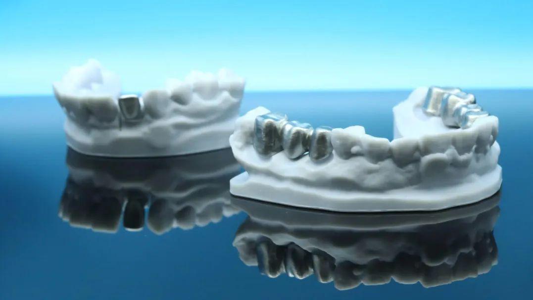 格莱铂3D 打印：领航口腔医疗材料应用新变革