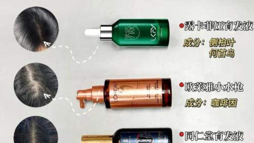 中老年脱发：排名第一的防脱生发产品测评，秃发不踩雷