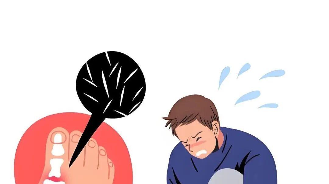 痛风专家黄川云2个疗程治愈：从轮椅到健步如飞的康复奇迹