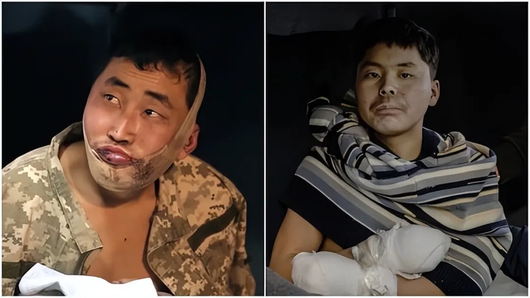 朝鲜伤兵宁死不当俘虏，高喊金正恩将军后，拉响手雷英勇就义