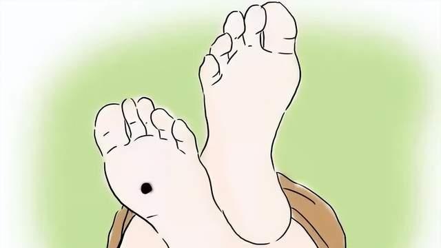 小心身上的痣，医生提醒：快速识别黑色素瘤，出现5类信号别忽视