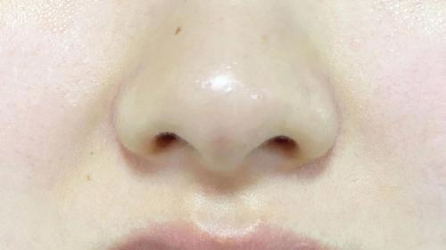 为什么建议牙套佩戴者每日使用专业清洁片？以雅克菱为例！