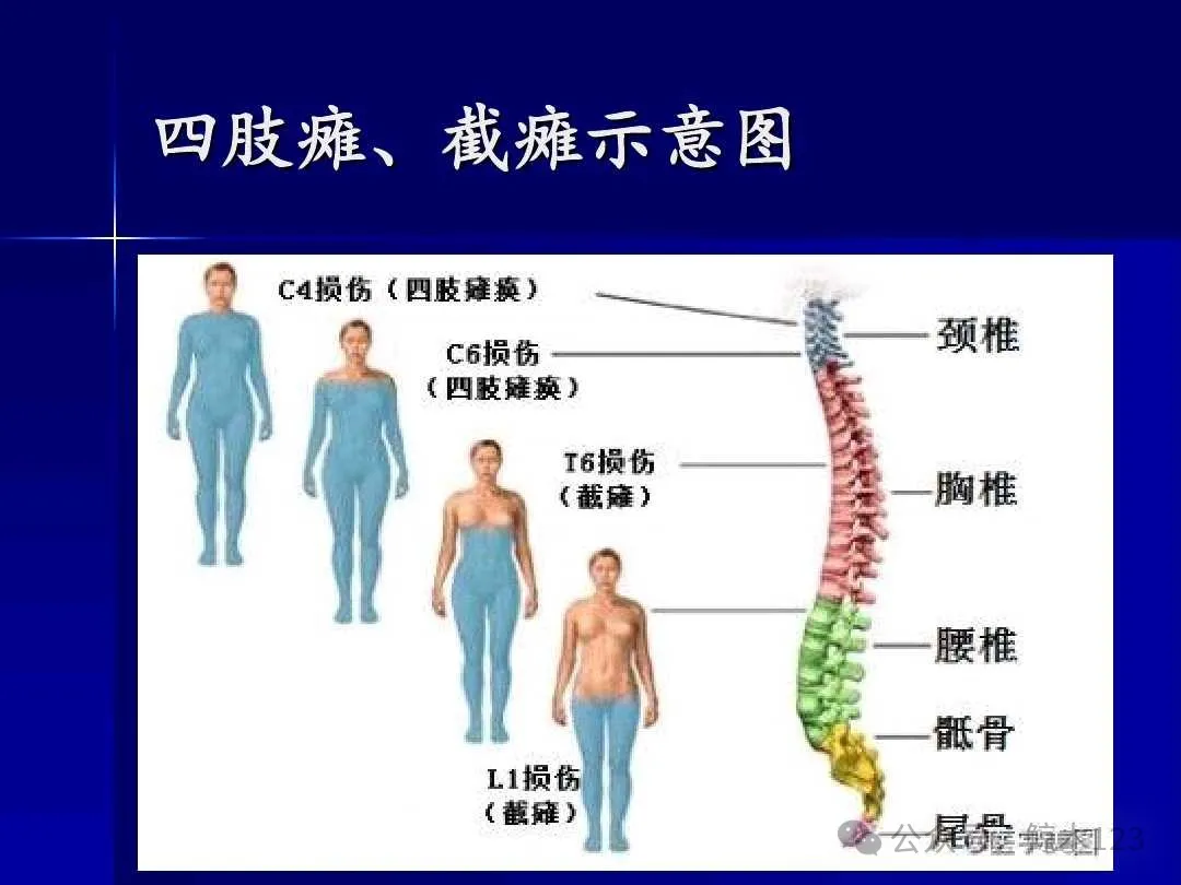 别让这些“隐藏杀手”加重脊髓损伤！