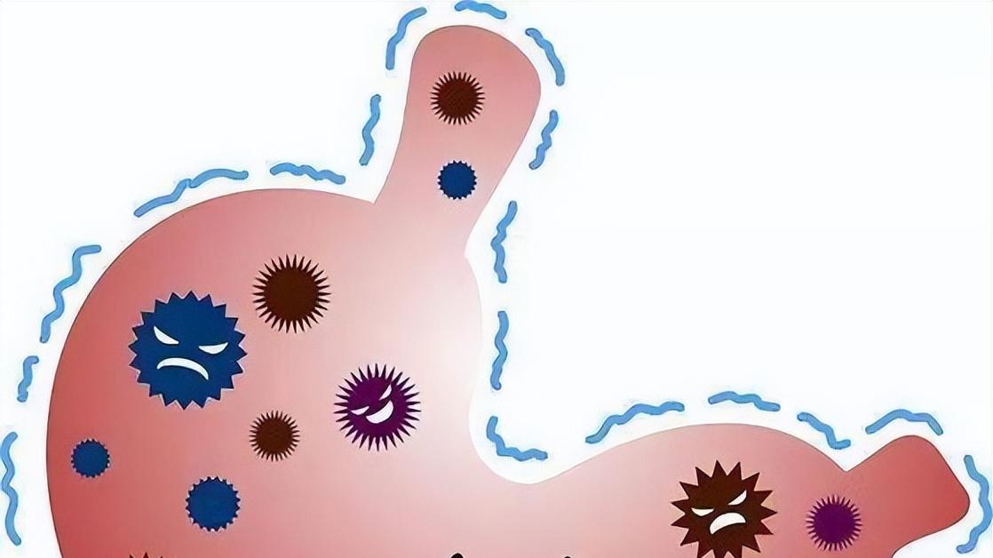 胃癌离你只有3个习惯，医生提示：90%的胃癌可以预防，就看这4步