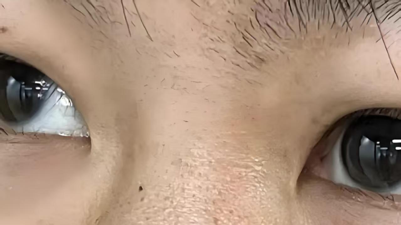 鼻头黑头总消不掉？厨房里这招轻松搞定！