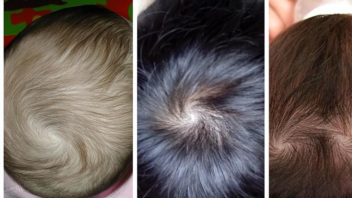 谁说两个“旋”的孩子更聪明？与其空谈，不如努力提高孩子智商