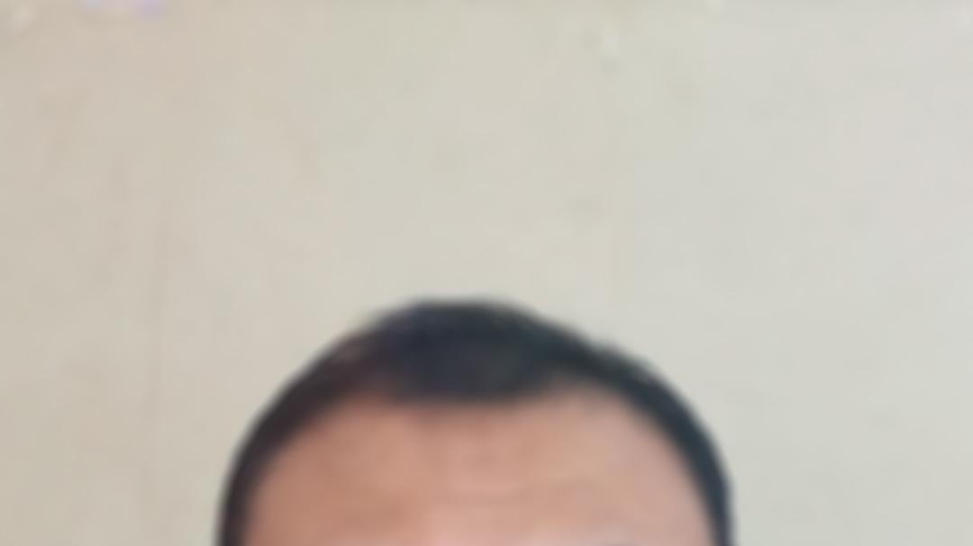 摄像头侵犯隐私怎么办？能强制拆除吗？门口安装监控要邻居同意吗