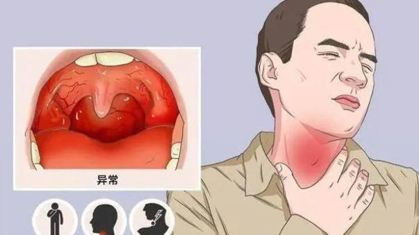 警惕！这些饮食习惯可能让慢性咽炎越拖越重！