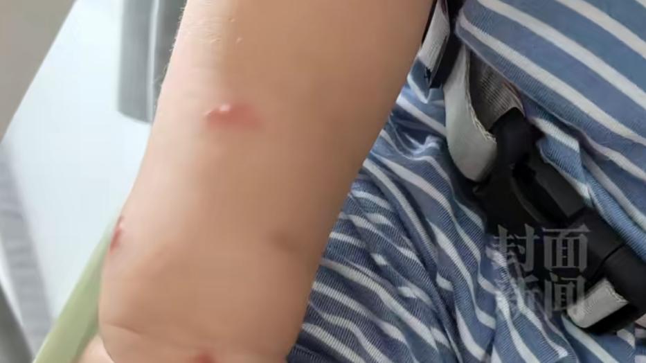 一女子强搂亲吻1岁多孩子 妈妈：孩子当晚就高烧，已被确诊是水痘