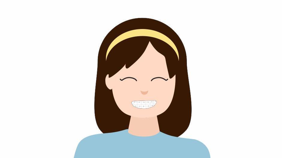 30岁戴牙套有后遗症？终身戴保持器、牙龈萎缩…这些“坑”真避不开吗？