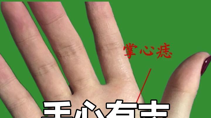 身上长这些痣可能霉运缠身