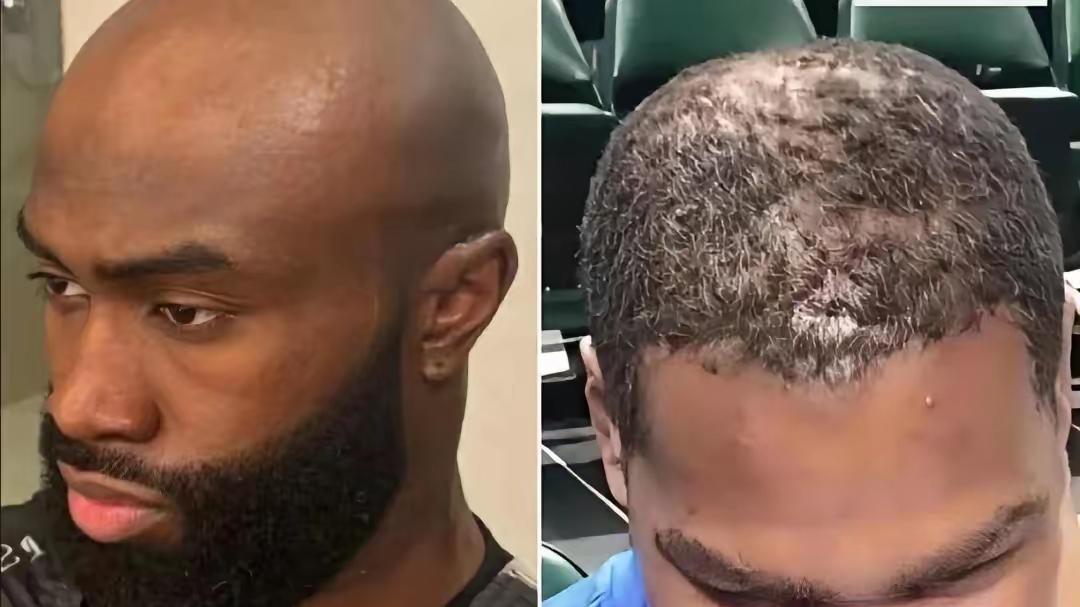 破铜笑烂铁，杜兰特调侃布朗剃光头，布朗回怼其头发像草坪