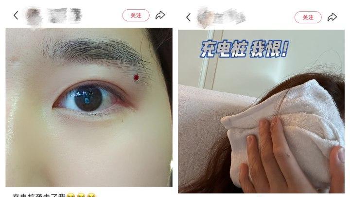 小鹏车主被充电枪打脸缝8针，引出一个新能源车行业的痛点