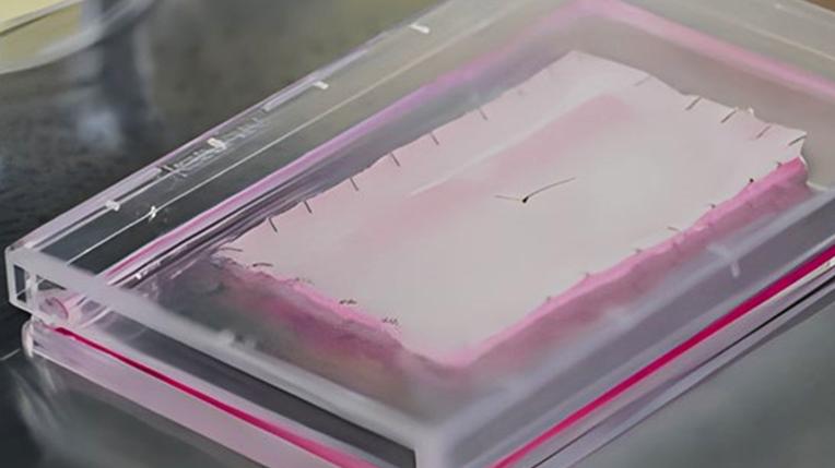 大疱性表皮松解症第三种疗法！FDA批准ZEVASKYN基因改进细胞薄片