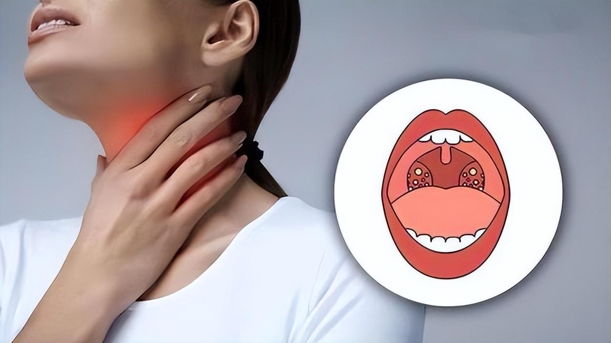 长期食用65℃以上食物和水，小心食管癌，别再趁热吃，做好预防