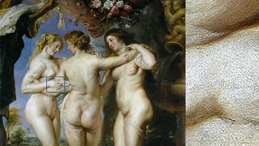 类风湿性关节炎的战争：人类与自身免疫系统的200年博弈