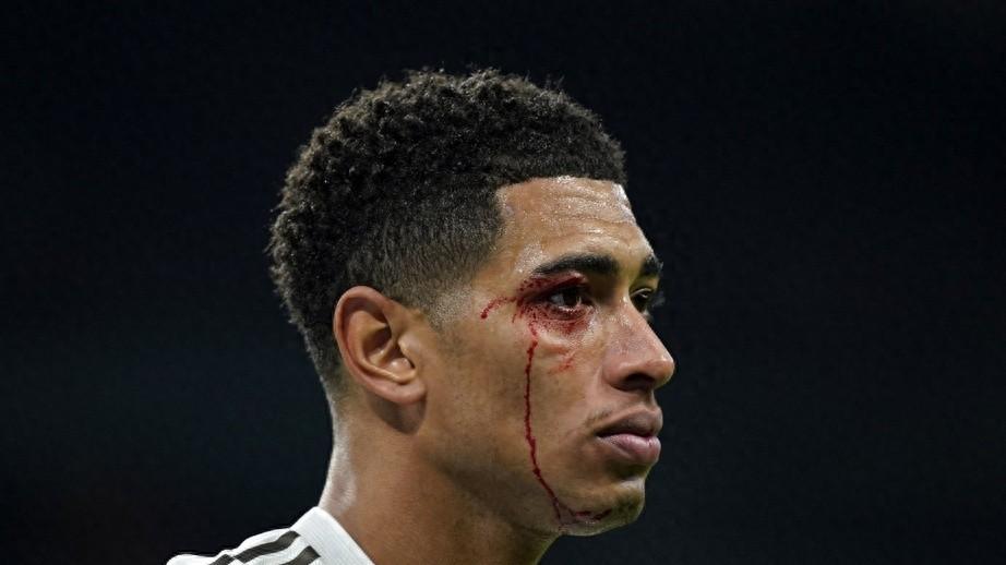 皇马主场0-2失利夜！