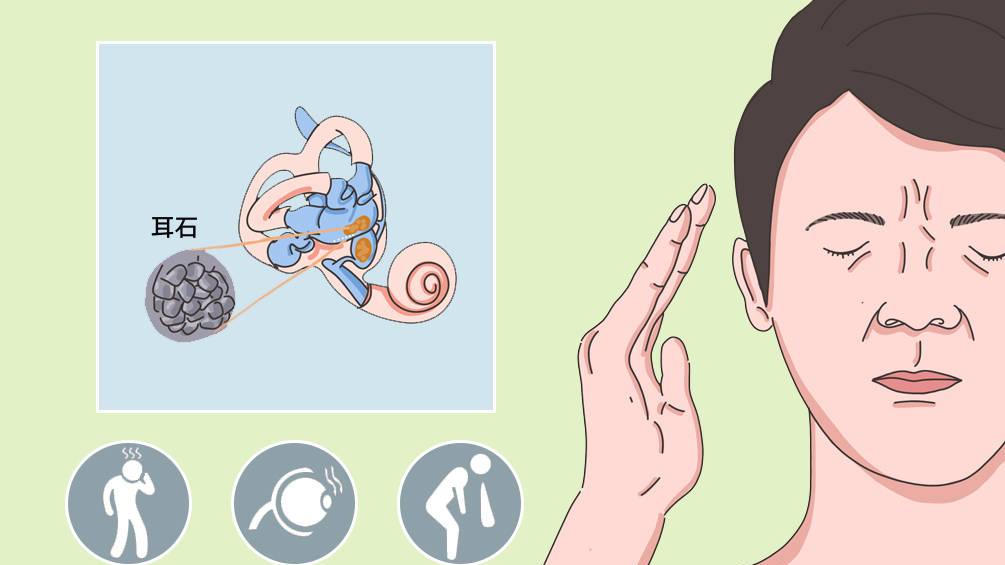 一转头就天旋地转？可能是“耳石”掉了！
