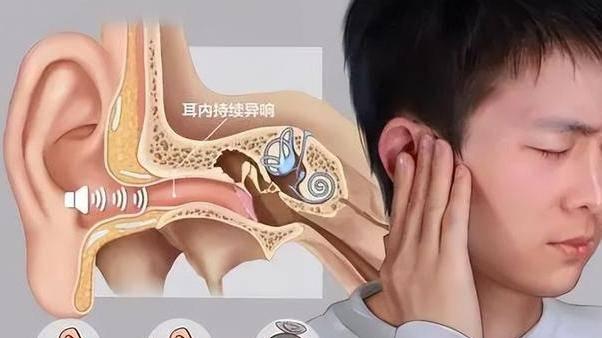 耳朵里像开“音乐会”？出现这些耳鸣，千万别硬扛！