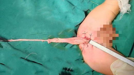 滨州市人民医院专家提醒：宝宝便秘，别总以为是“攒肚”