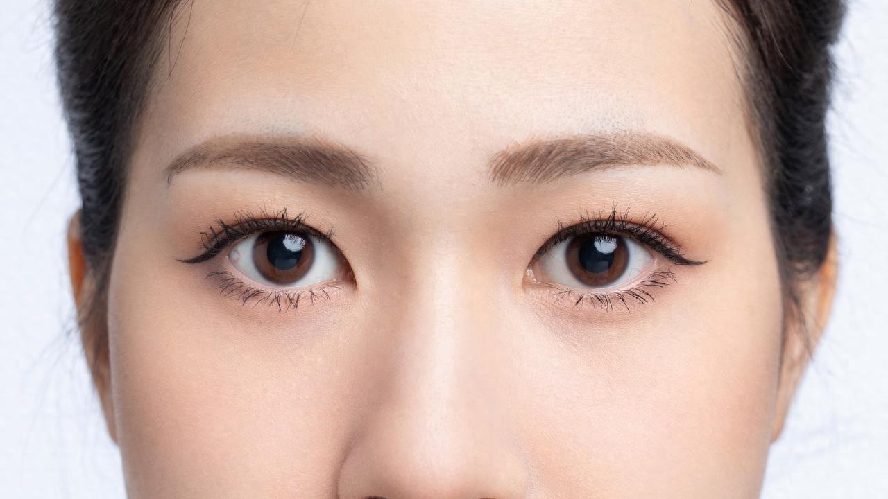 泪沟想改善？过来人唠唠真实效果，自然不踩坑才是关键