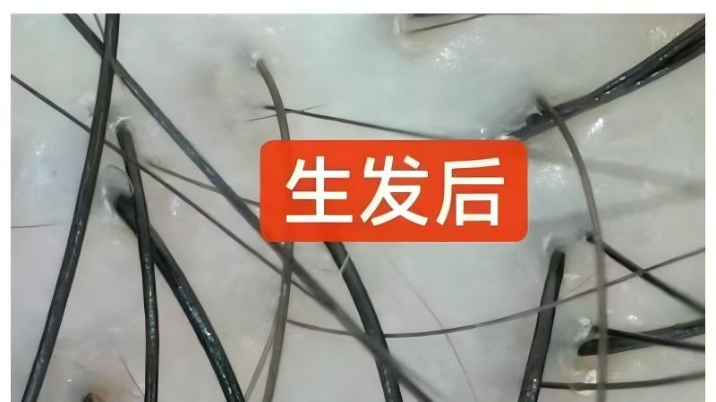 乌黑亮丽的秀发：健康与自信的象征