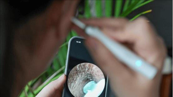 儿童掏耳朵怎么掏比较好？分享十大好用的儿童掏耳工具！