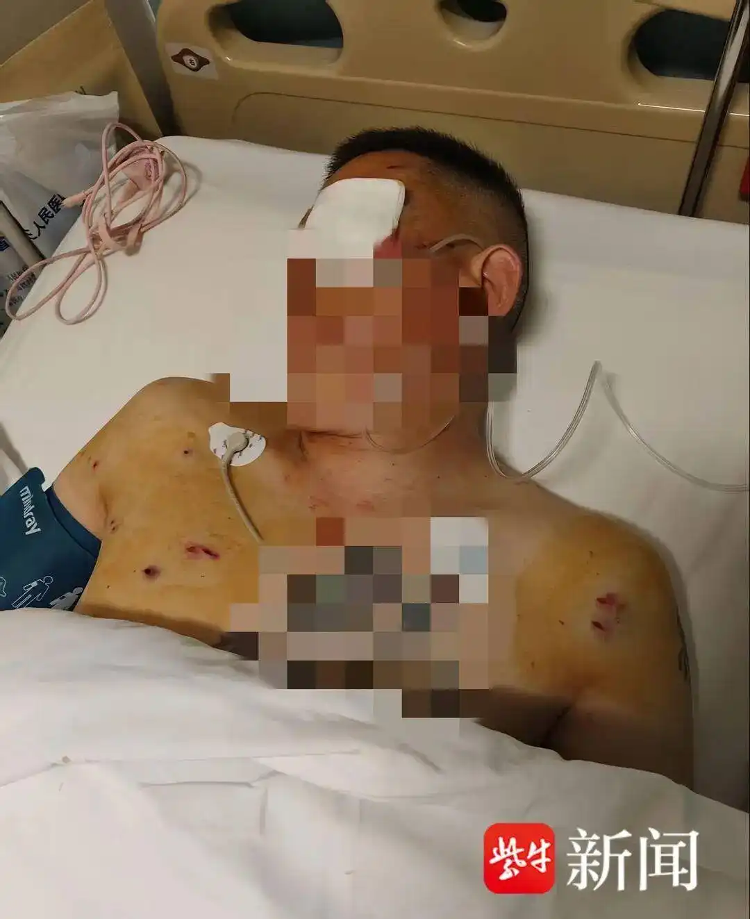 储户取现遭抢劫，银行有过错吗？