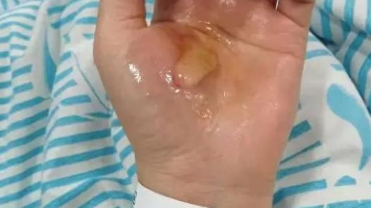 洗澡时突然倒下！35岁女子死里逃生，背后事实让所有人后背发凉…