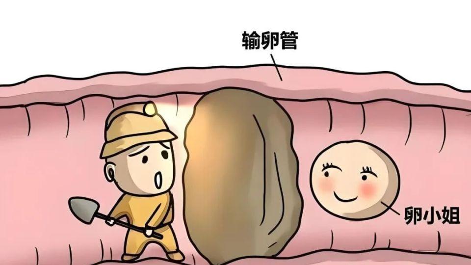 昆明送子鸟：什么是卵巢障碍？备孕的你一定要知道